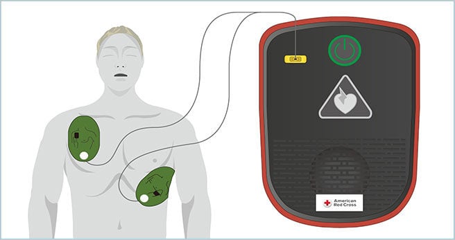 SmartCPR_AEDUtilizations