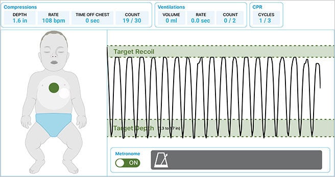 SmartCPR_CPRCycles