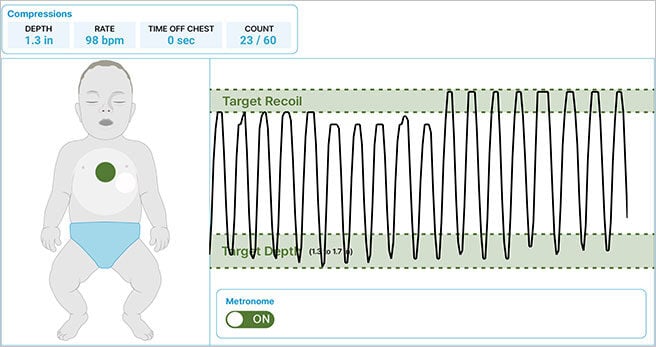 SmartCPR_Compressions