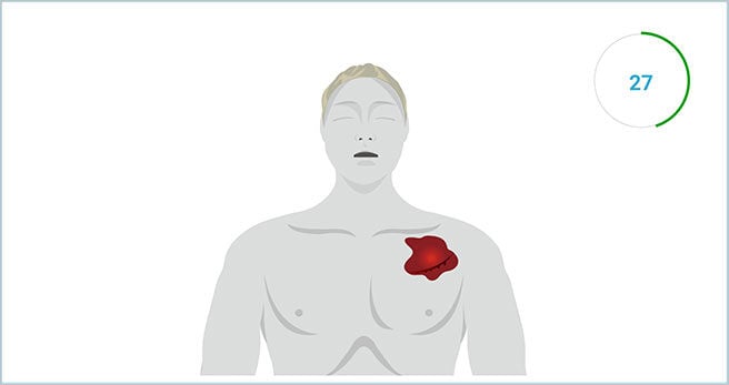 SmartCPR_DirectPressure