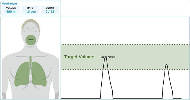 SmartCPR_Ventilhations