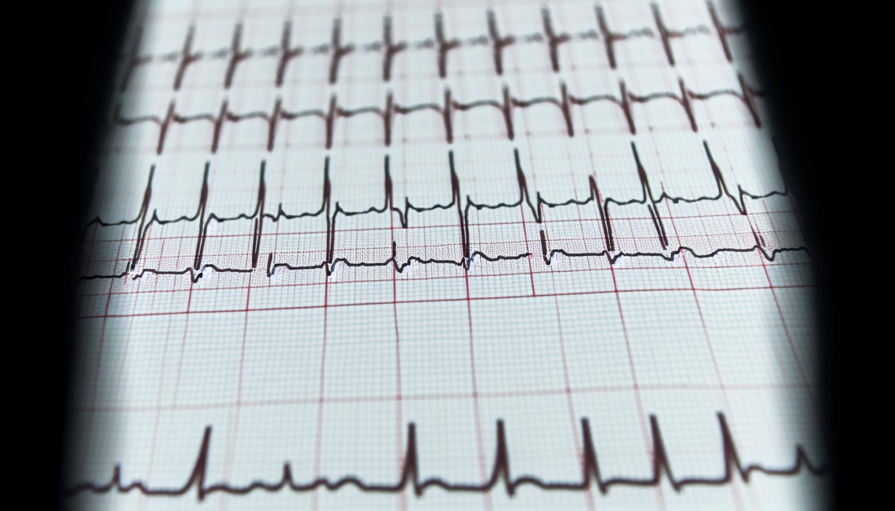 EKG paper